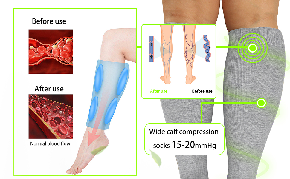 medical compression socks